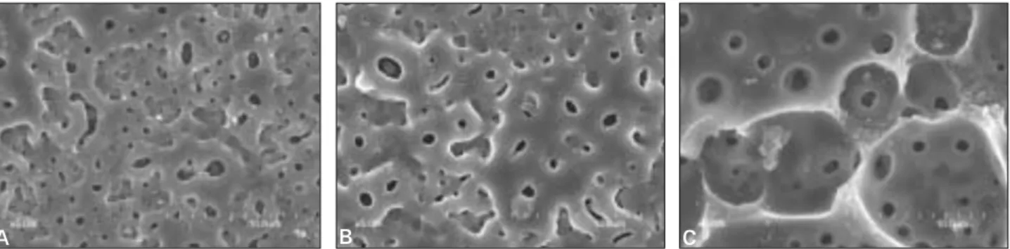 Fig. 2. SEM images of three treated surfaces (Magnification × 5000).