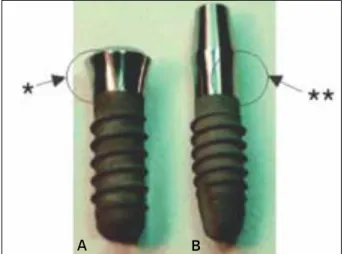 Fig. 1. A: A thin one piece implant model (NobelDirect � 3.0, TiUnite � surface-99kb)