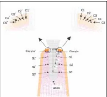 Fig. 8. Typical overall stress distribution in the implant/bone complex (Base model subject to a vertical load of 50 N).