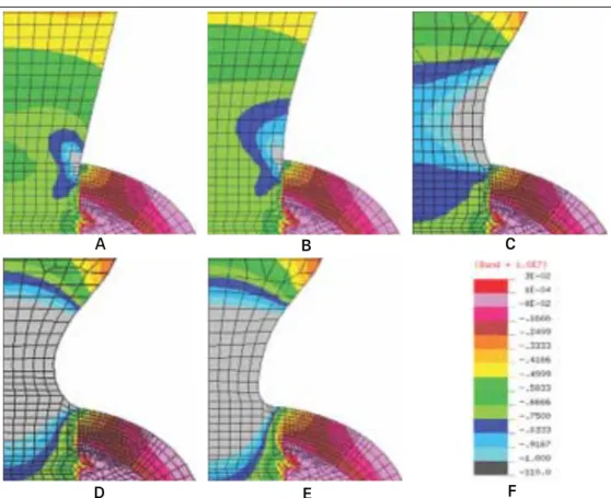 Fig. 9. Stress distribution at the cervix of five different models subject to a vertical load of 50 N.