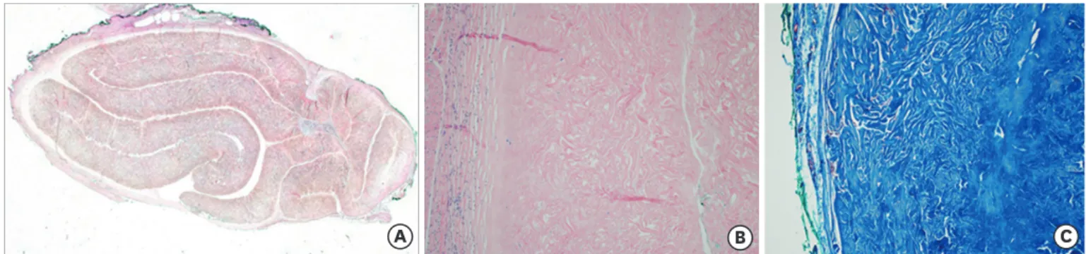 Fig. 3. Histopathologic result of artificial ADM. (A) H&amp;E staining showed well defined, nodular connective tissue (×12.5)