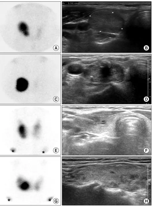 Fig. 1. Thyroid ultrasonography and 