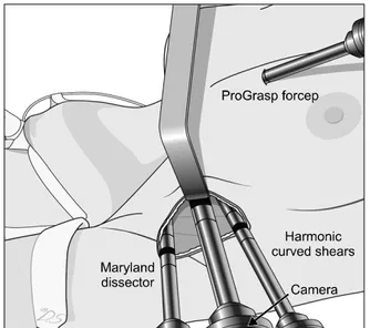 Fig. 1. Two-incision  robotic  thyroidectomy;  A  second  0.6∼0.8  cm-long  skin  incision  was  created  on  the  tumor  side  of  the  anterior  chest  wall  to  allow  insertion  of  the  fourth  robotic  arm  (with  a  ProGrasp  forceps)