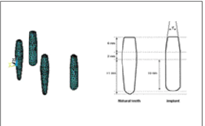 Fig. 1. Modeling of mandible. Fig. 2. Modeling of implant, natural teeth, and abutment