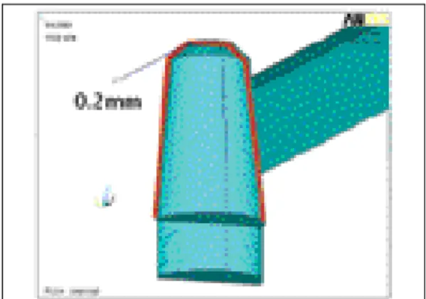 Fig. 3. Modeling of outer crown and connector. Fig. 4. Relationship between outer crown and abutment.