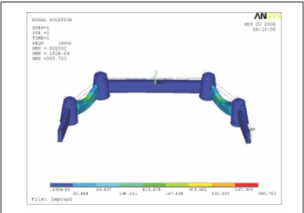 Fig. 9. Stress Distribution of outer crown and connector - -experimental group (Load case 1)