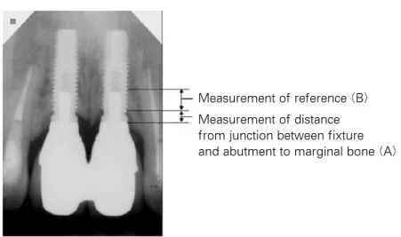 Fig. 1.  Example of measurement of distance and reference.