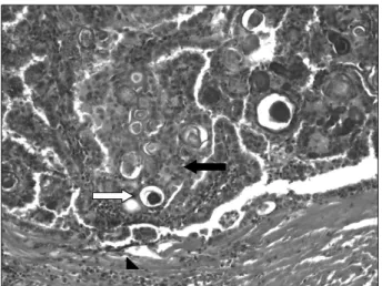 Fig.  4.  Histopathologic  appearance  of  the  DSPC  (H&amp;E  stain, 