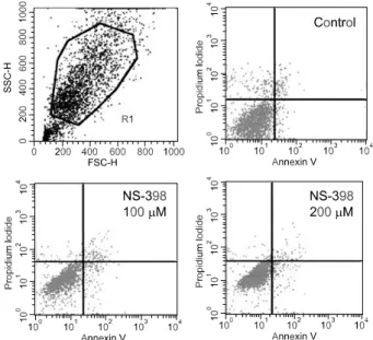 Fig.  5.  Changes  in  cell  cycle  after  48  hour  treatment  with  NS-398  in  TPC-1  cell  line