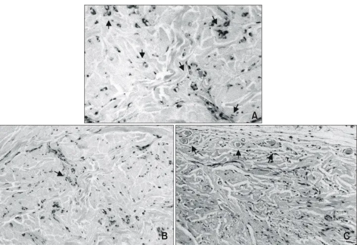Table  5.  Effects  of  thyroid  function  on  angiogenesis  and  VEGF  level  in  nude  mice