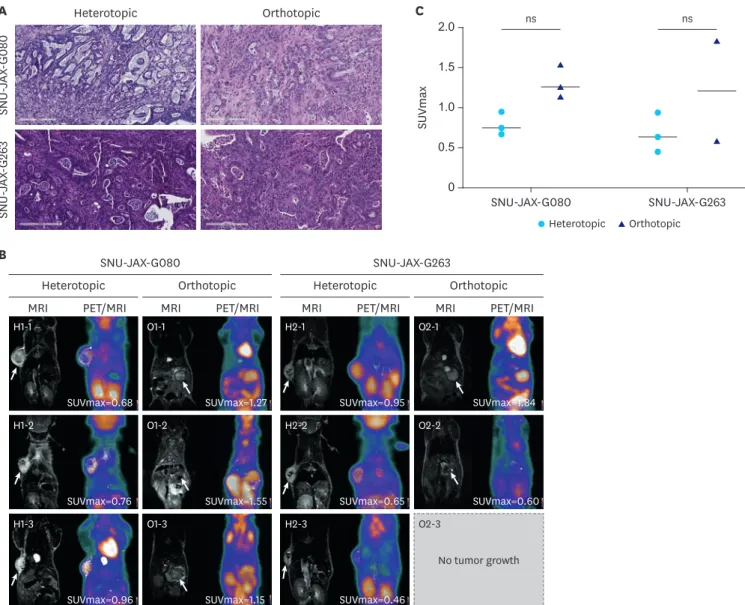 Fig. 4. Comparison of corresponding PDX tissue in heterotopic and orthotopic models. (A) Representative H&amp;E staining images of tumor growth in established  models (H&amp;E stain, ×200)