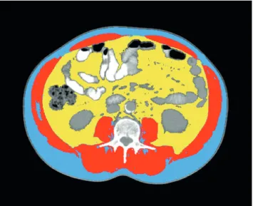 Fig. 1. Axial CT images of the third lumbar vertebra region. CT was analyzed for muscle and fat tissue cross sectional  areas and analyzed using appropriate software