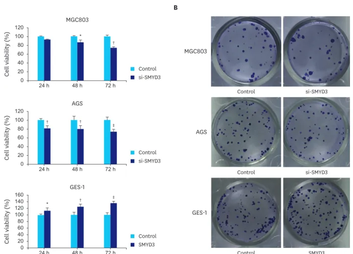 Fig. 2. Knockdown of SMYD3 could inhibit the proliferation of gastric cancer cells. MGC-803 and AGS gastric cancer cells were transfected with si-SMYD3 and cell  viability was analyzed by MTT assays at various time points (A)