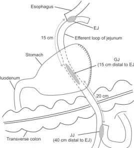 Fig. 4. The postoperative wound. There was no wound problem at the  postoperative day 20th.