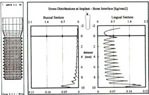 Figure 16. Equivalent Stress Distributions at Implant-Bone Interface of Model A. 3. 2.