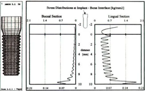 Figure 18. Equivalent Stress Distributions at Implant-Bone Interface of Model A. 4. 1.