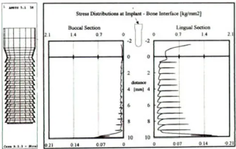 Figure 13. Equivalent Stress Distributions at Implant-Bone Interface of Model A. 2. 2.