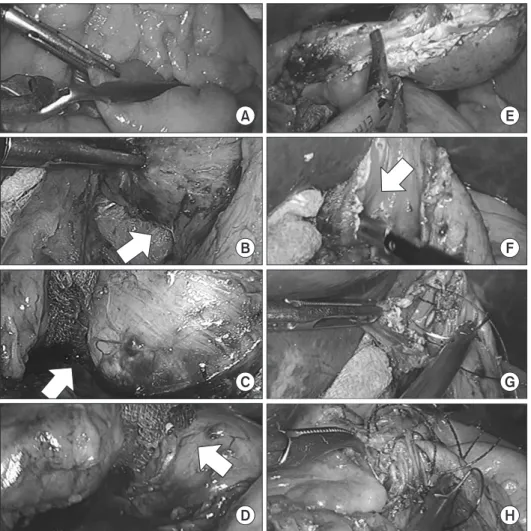 Fig. 2. Laparoscopic procedures. 