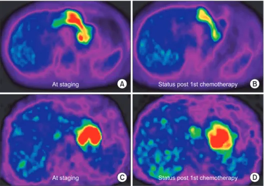 Fig. 3. Changes in fluorodeoxyglucose  (FDG) uptake of the primary tumors  on positron emission tomography/