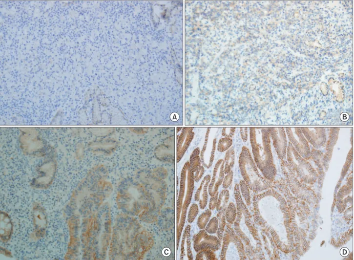 Fig. 1. Immunohistochemical analysis of human epidermal growth factor receptor 2 protein expression (×200)