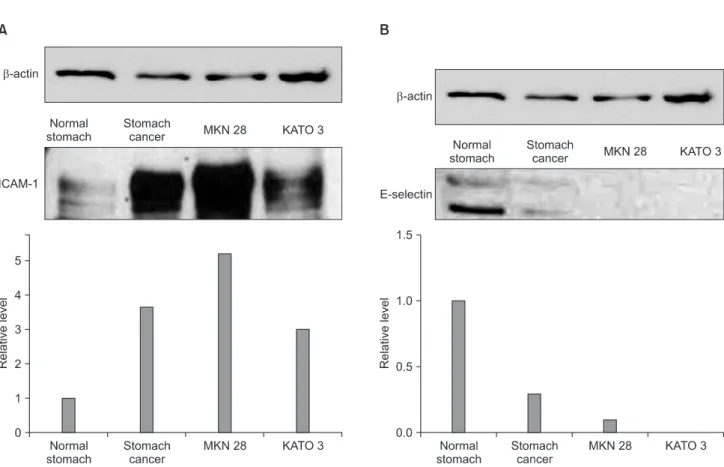 Fig. 1. Intercellular adhesion molecule-1 (ICAM-1), E-selectin expression level in gastric cancer tissues and cell lines (MKN28, KATO3)