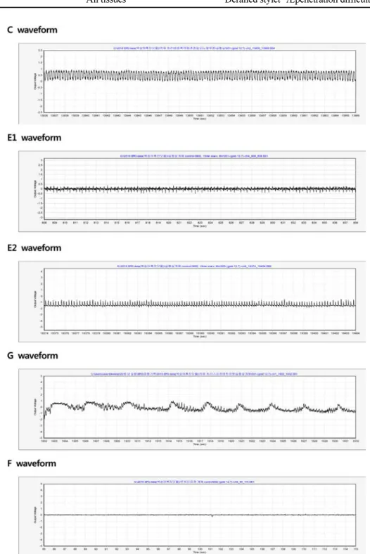 Fig. 2. Characteristics of EPG waveforms recorded from Myzus persicae.