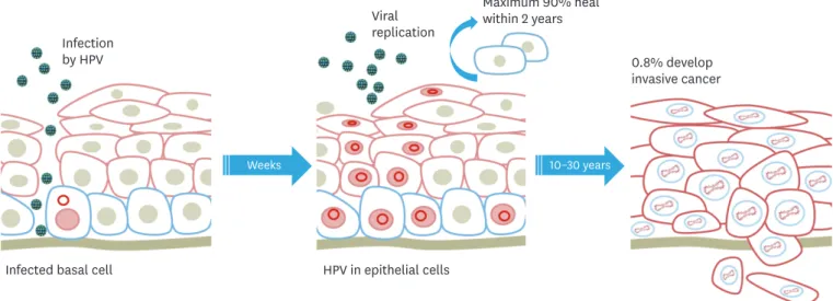 Fig. 1. Progression of cervical disease after human papillomaviruses infection. 