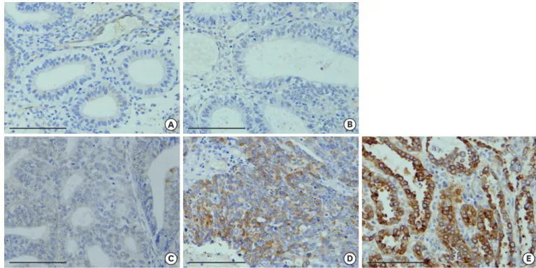 Fig. 1. LAMC1 expression pattern in endometrial tissues. (A) Normal endometrium (proliferative phase)