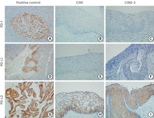 Fig. 1. Representative images of immunohistochemical staining for cervical intraepithelial neoplasms