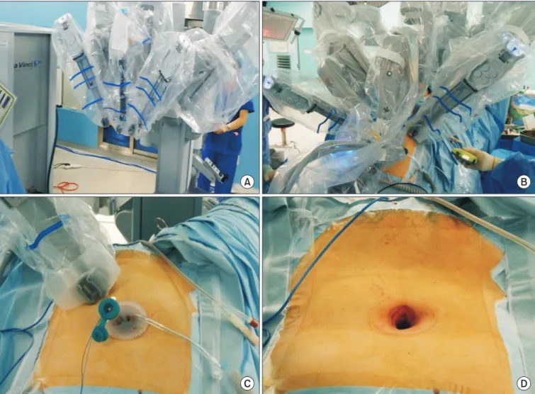 Fig. 1. The da Vinci Si Surgical system. (A) Before docking. (B) After docking. (C) Platform