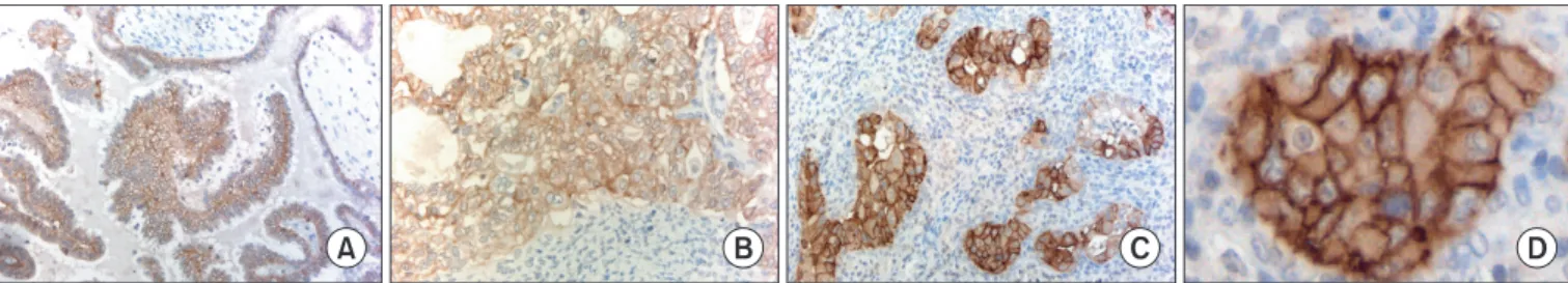 Fig. 2. Overall survival illustrated for patients with different epithelial  cell adhesion molecule (EpCAM) expression rates (n=74).