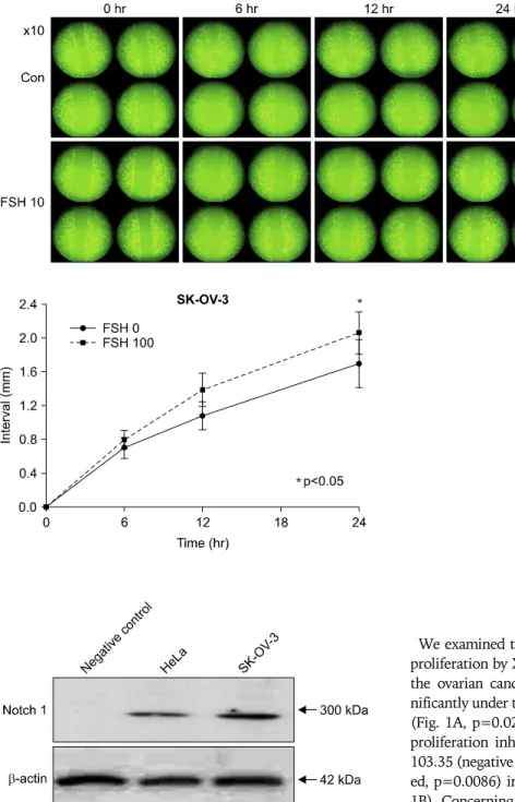 Fig. 2. Cell migration assay by slit  tests shows that follicular  stimula-ting hormone (FSH) 100 mIU/ mL  made more distant movement of  cells dependent on time than the  control (FSH 0 mIU/mL).