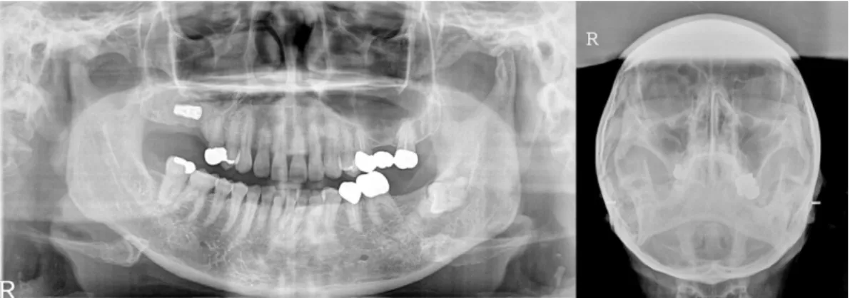 Fig. 8. Case 3: Panorama view obtained six months after the first examination. 