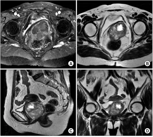 Fig. 1. Pre-operative MR images. 
