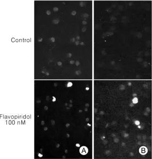Fig.  2.  Ovarian  cancer  cell  lines,  TOV-21G  (A)  and  TOV-112D  (B)  labelled  by  the  TUNEL  method