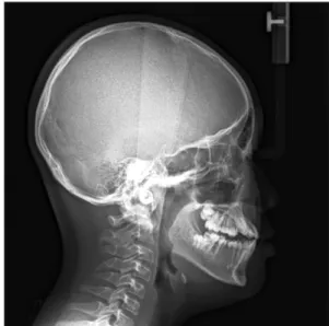 Fig. 9. Panorama image of the patient at the end of the first-phase  orthodontic treatment.