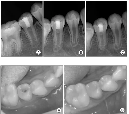 Fig. 3. One month after triple antibiotics were applied.