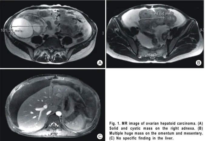 Fig. 2. Gross feature of uterus and hepatoid carcinoma  of ovaries.