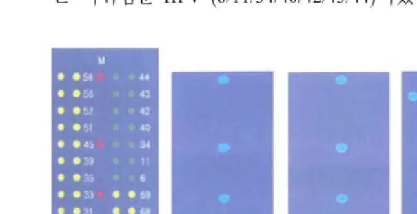 Fig.  1.  Examples  of  HPV  DNA  Chip ® .
