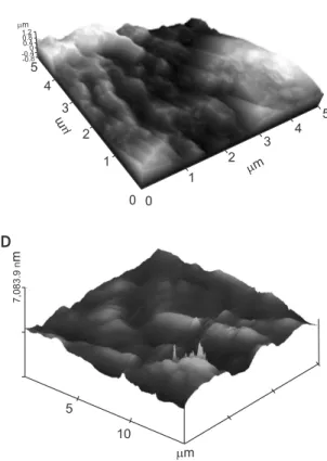 Fig. 2. The atomic force microscope Images of surfaces control (A),  acid-etching (B), alkali-heat (C), sandblasting with large grit and acid  etching (D), resorbable blasted media (E) discs.