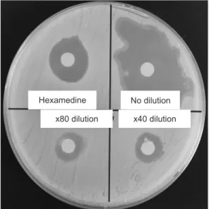 Fig. 3. Disc diffusion assay for Salmonella typhi resistance. Undiluted  and diluted gargles were applied to the disc as compared to  Hexame-dine solution.