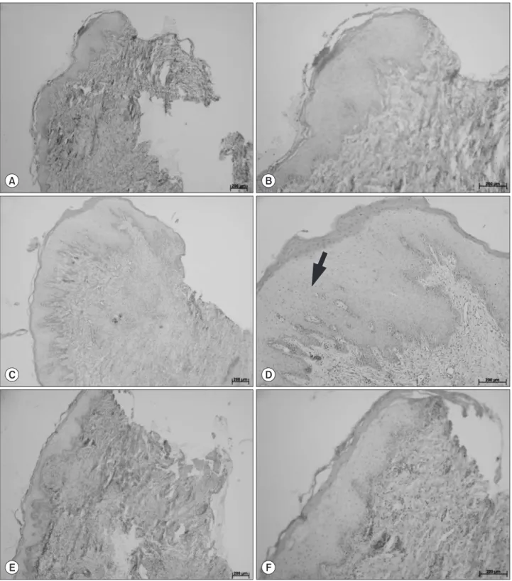 Fig. 4. Histological view. (A, B) Apically repositioned flap (APF) only group. (C, D) APF combined with free gingival graft group (black arrow: 