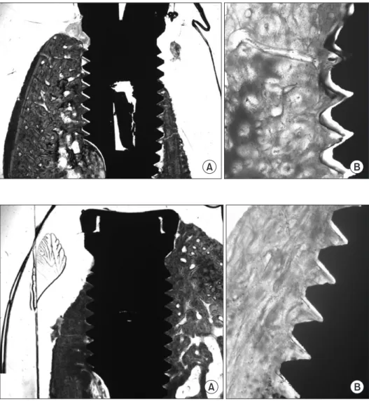 Fig. 1. Machined-surface implants at 4  weeks. Partial trabecular bone growth  was seen between the threadsin  im-plant (Villanueva osteochrome bone  stain; A: ×12.5, B: ×40).