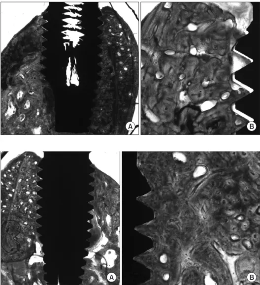 Fig. 3.  Particulated-dentin coated  implants at 4 weeks. Trabecular bone  growth was seen between the threads  in implant and also compact bone was  partially seen at the same area  (Vil-lanueva osteochrome bone stain; A: 