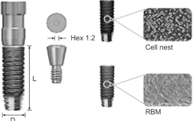 Fig. 5. Panoramic view after retrieving test implants and installing  wide implants.