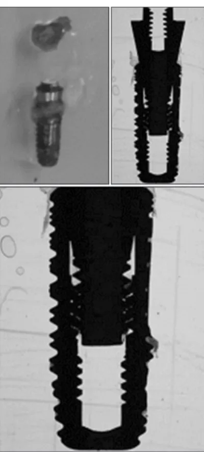 Fig. 7. Histomorphometric view of #16 implant (5 days-immediate  load test group). 