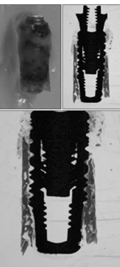 Fig. 10. Bone-to-implant surface contact (BIC), bone area in diagram.