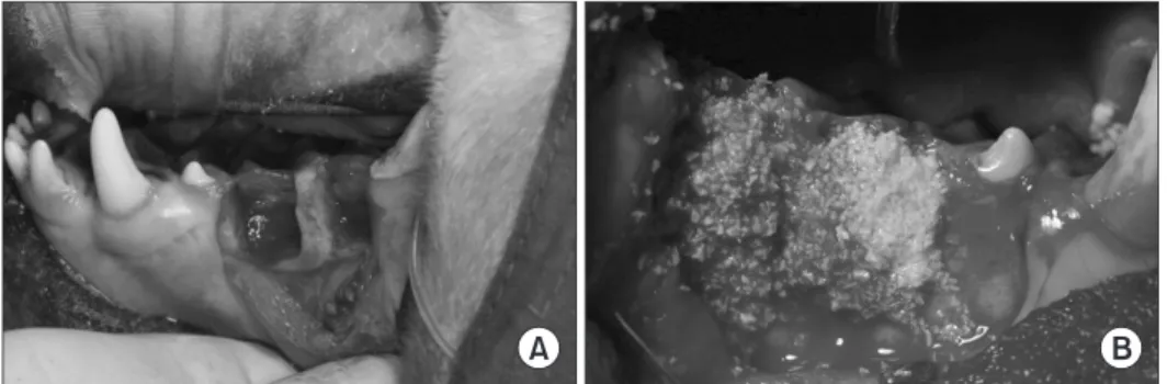 Fig. 1.  (A)  Intentional  bone  defects  were formed. (B) Bone graft materials  were filled.