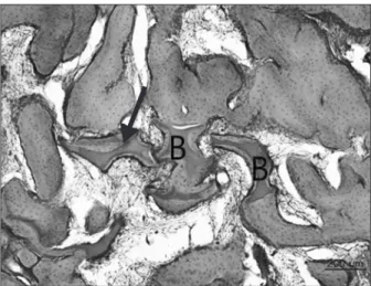 Fig. 9. Histologic finding 8 weeks of Group 2. Most bone defect was  filled with mature lamellar bone (H&amp;E, ×100).