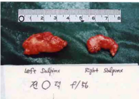 Fig. 3. Formation of thin sheets and nests of squamous cell